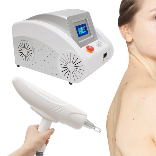 Tattoo removal machine - tattoo,